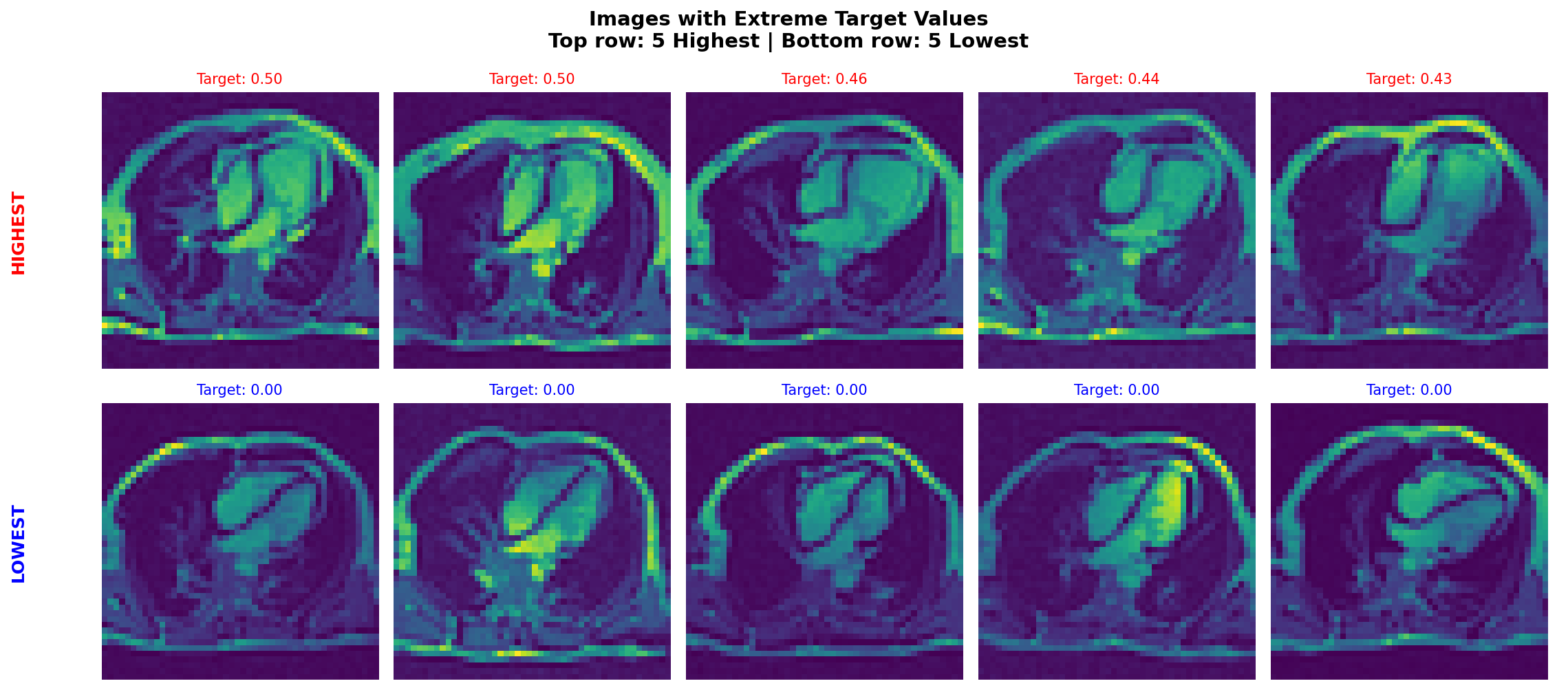 Disease Detection – Machine Learning preview